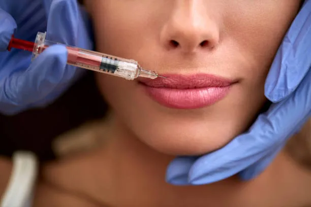 Rejuvenecimiento Labial